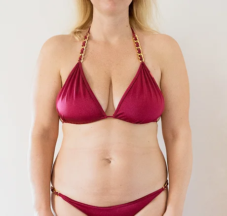 before weight loss image of sarah